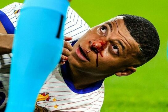 Спортивный врач назвал главную проблему для Мбаппе на Евро-2024 после перелома носа