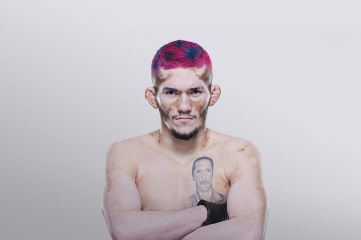 Мелкизаэл Коста